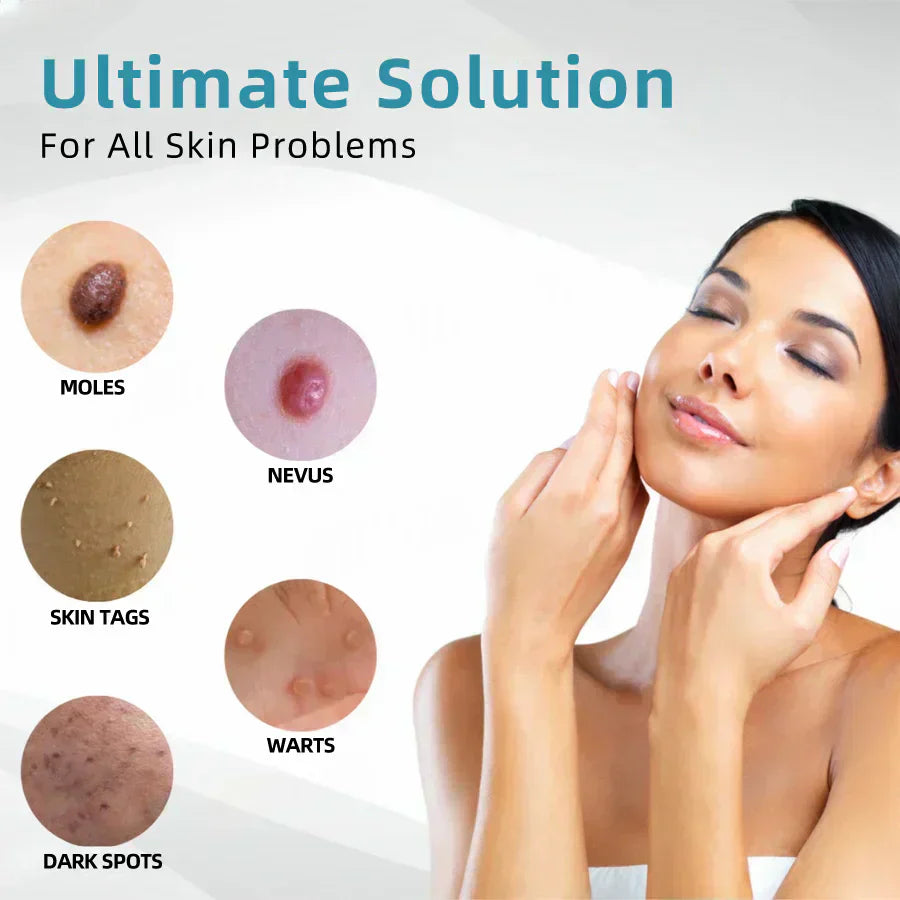 ✨Ringmiz All-in-One CO₂ Laser Eraser Pen | Removes Moles, Warts, Skin Flaws & Pigmentation