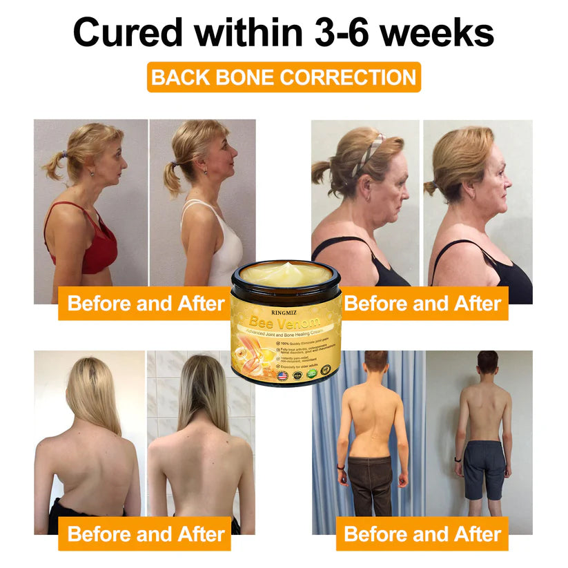 RINGMIZ Bee Venom Advanced Joint and Bone Healing Cream