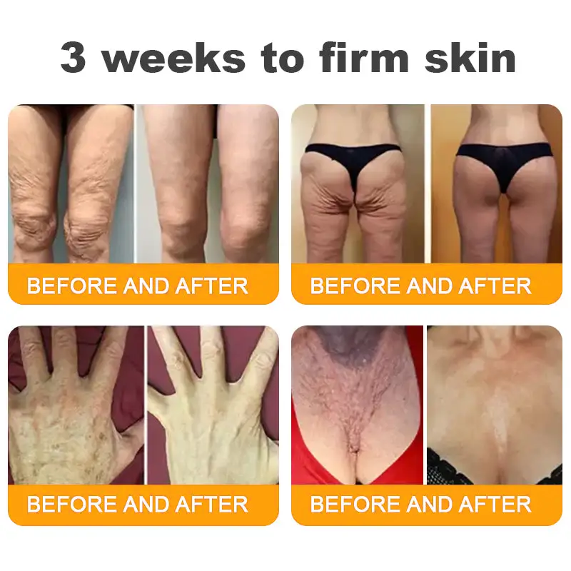 Made and Shipped from USA ✨ RINGMIZ Bee Venom Skin Restoration Cream ⏰ LAST DAY 80% OFF💌