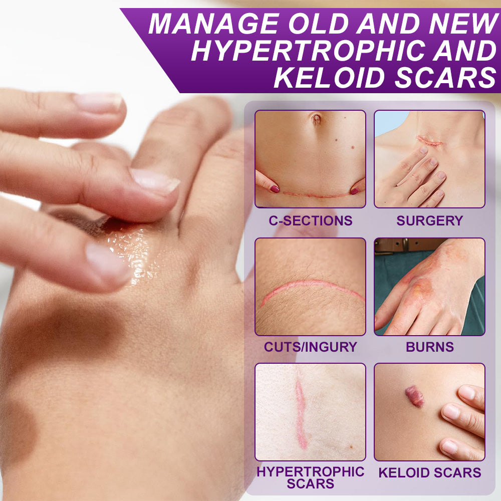 💙💙UKCA-CERTIFIED ✅RINGMIZ cure FACE & BODY SCAR GEL – Clinically proven to soften, flatten and fade surgical scars, acne marks, burns, keloids and trauma-related scars.