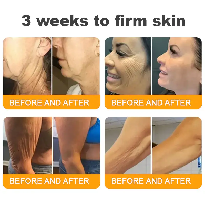 Made and Shipped from USA ✨ RINGMIZ Bee Venom Skin Restoration Cream ⏰ LAST DAY 80% OFF💌