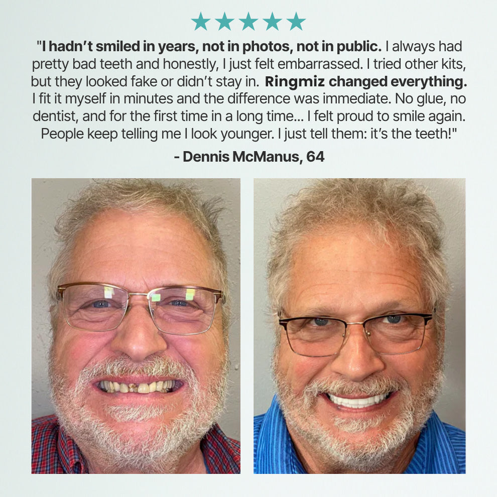 Ends Today: 70% OFF! Ringmiz? Custom-Fit Full Functional DenturesMake you more confident