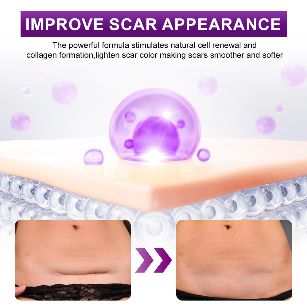 💙💙UKCA-CERTIFIED ✅RINGMIZ cure FACE & BODY SCAR GEL – Clinically proven to soften, flatten and fade surgical scars, acne marks, burns, keloids and trauma-related scars.