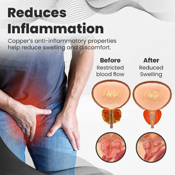 【 ✨Official Brand Store ✨】Ringmiz Copper Mag Prostate Therapy Ring(Limited Time Discount 🔥 Last Day)