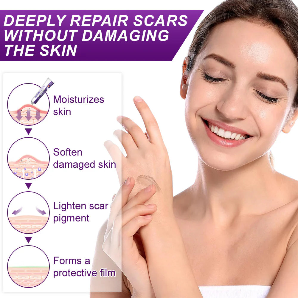 💙💙UKCA-CERTIFIED ✅RINGMIZ cure FACE & BODY SCAR GEL – Clinically proven to soften, flatten and fade surgical scars, acne marks, burns, keloids and trauma-related scars.