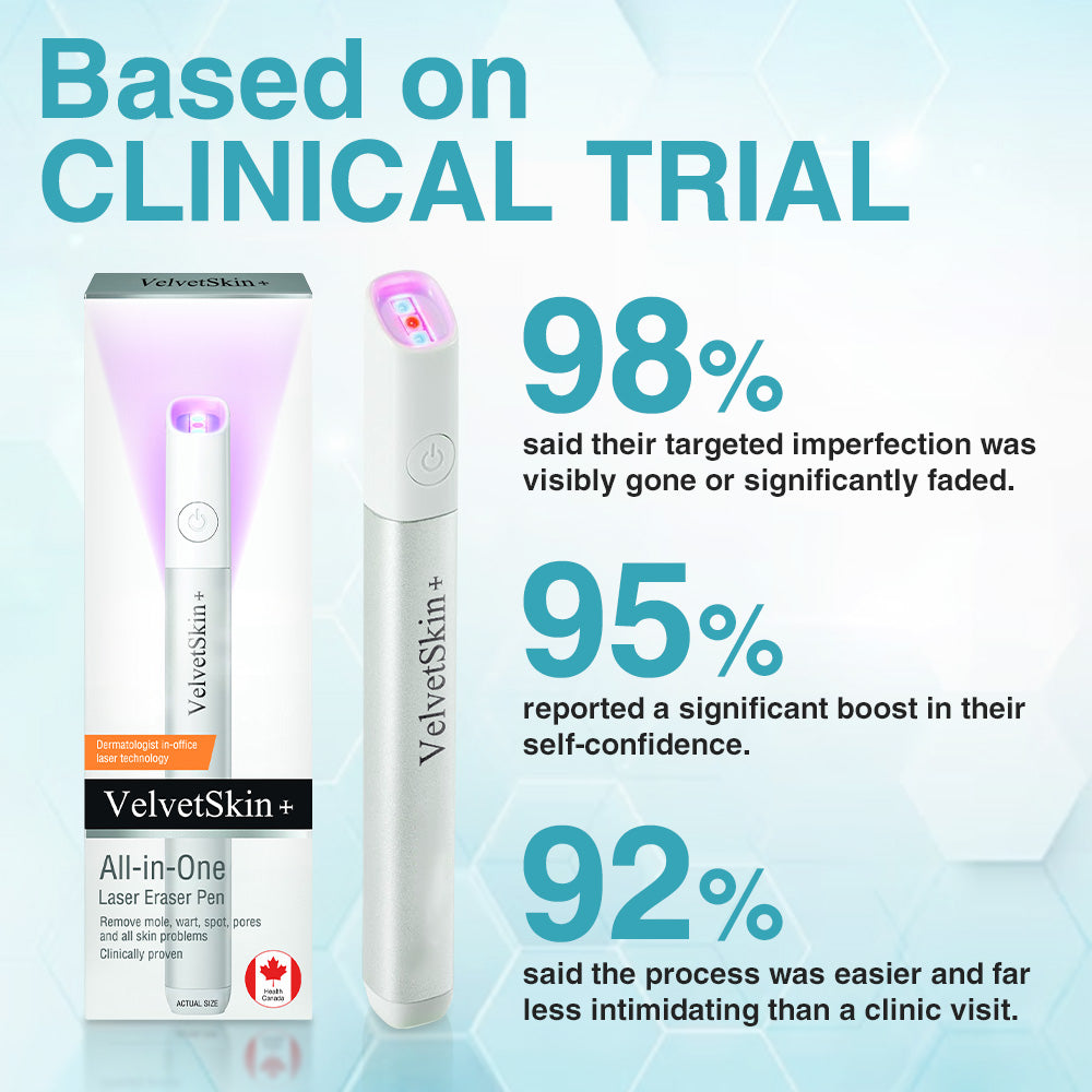 ✨Ringmiz All-in-One CO₂ Laser Eraser Pen | Removes Moles, Warts, Skin Flaws & Pigmentation