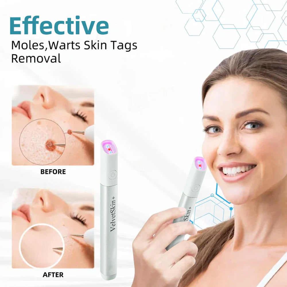 ✨Ringmiz All-in-One CO₂ Laser Eraser Pen | Removes Moles, Warts, Skin Flaws & Pigmentation