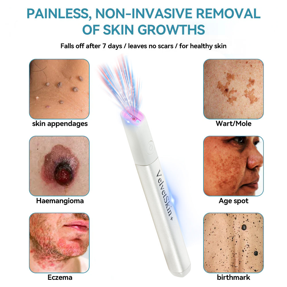 ✨Ringmiz All-in-One CO₂ Laser Eraser Pen | Removes Moles, Warts, Skin Flaws & Pigmentation