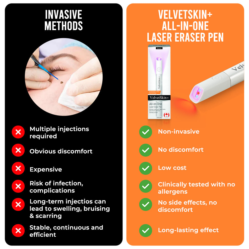 ✨Ringmiz All-in-One CO₂ Laser Eraser Pen | Removes Moles, Warts, Skin Flaws & Pigmentation