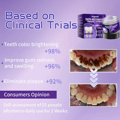 Ringmiz Teeth Restoration Mineral Powder