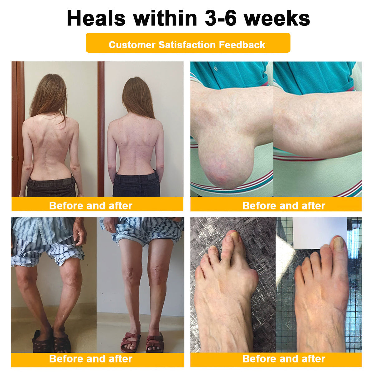 🎁Flash Sale - Ringmiz Botulinum Toxin & Bee Venom Pain-Relief Bone Healing Cream🐝💎