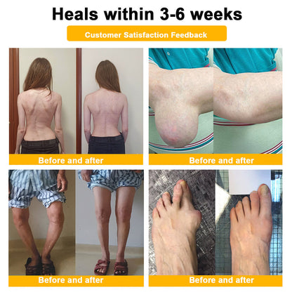 🎁Flash Sale - Ringmiz Botulinum Toxin & Bee Venom Pain-Relief Bone Healing Cream🐝💎