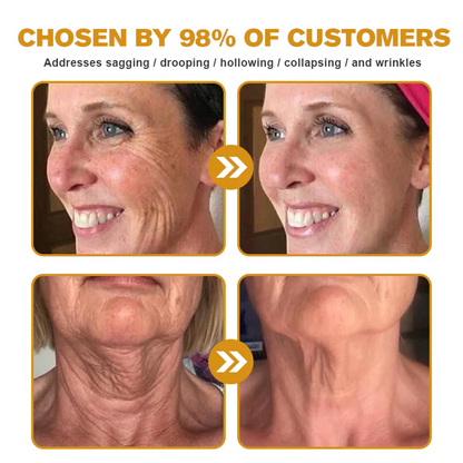FDA Approved: Ringmiz Bee Venom Skin Restoration Cream — 🔥Limited Time 70% OFF🔥