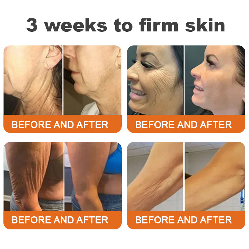 🐝🏅Ringmiz Botox Bee Venom Firming Serum Stick-(Made and Shipped from Australia)-LAST DAY 70% OFF