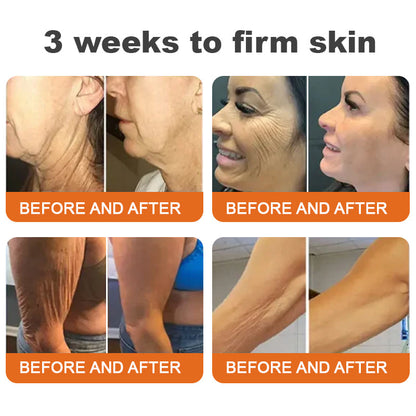 🐝🏅Ringmiz Botox Bee Venom Firming Serum Stick-(Made and Shipped from Australia)-LAST DAY 70% OFF