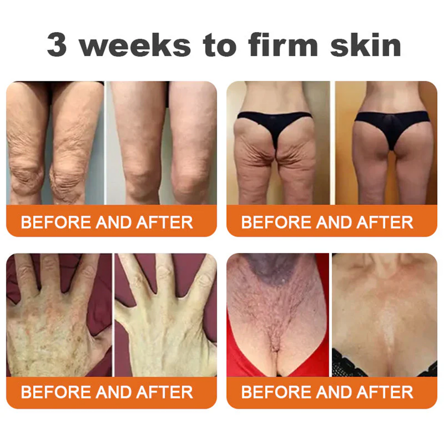 FDA Approved: Ringmiz Bee Venom Skin Restoration Cream — 🔥Limited Time 70% OFF🔥