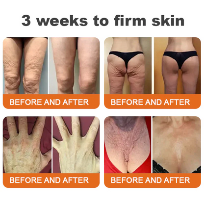 FDA Approved: Ringmiz Bee Venom Skin Restoration Cream — 🔥Limited Time 70% OFF🔥
