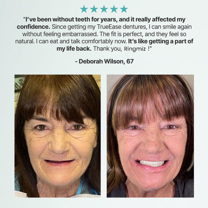 Ends Today: 70% OFF! Ringmiz? Custom-Fit Full Functional DenturesMake you more confident